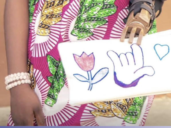 Le Rotary Club de Cotonou Nexus redonne des mains… et de l’espoir